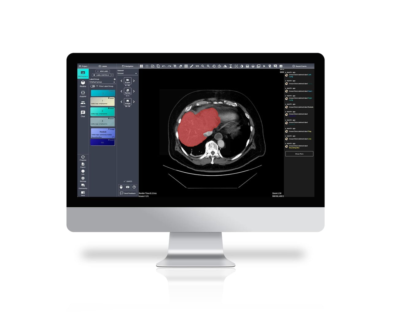 Medical AI Web Platform